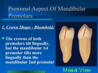 Proximal Aspect Of MandibularProximal Aspect Of Mandibular
PremolarsPremolars
1. Crown Shape - Rhomboid:
The crowns of bo...