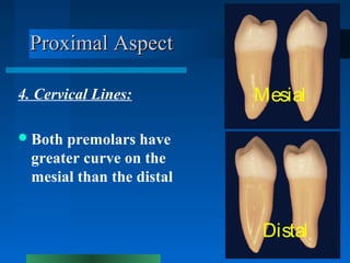 Proximal AspectProximal Aspect
4. Cervical Lines:
Both premolars have
greater curve on the
mesial than the distal
Mesial
...