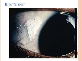 4/23/2023
18
Getnet
A.
BITOT’S SPOT
 