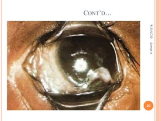 CONT’D…
4/23/2023
20
Getnet
A.
 