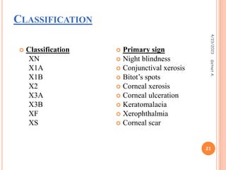 CLASSIFICATION
 Classification
XN
X1A
X1B
X2
X3A
X3B
XF
XS
 Primary sign
 Night blindness
 Conjunctival xerosis
 Bitot’s spots
 Corneal xerosis
 Corneal ulceration
 Keratomalacia
 Xerophthalmia
 Corneal scar
4/23/2023
21
Getnet
A.
 