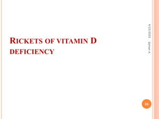 RICKETS OF VITAMIN D
DEFICIENCY
4/23/2023
26
Getnet
A.
 