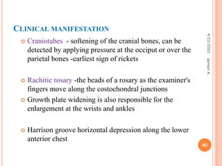 CLINICAL MANIFESTATION
 Craniotabes - softening of the cranial bones, can be
detected by applying pressure at the occiput or over the
parietal bones -earliest sign of rickets
 Rachitic rosary -the beads of a rosary as the examiner's
fingers move along the costochondral junctions
 Growth plate widening is also responsible for the
enlargement at the wrists and ankles
 Harrison groove horizontal depression along the lower
anterior chest
4/23/2023
40
Getnet
A.
 