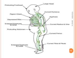 4/23/2023
42
Getnet
A.
 