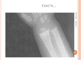 CONT’D…
4/23/2023
48
Getnet
A.
 