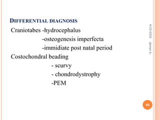 DIFFERENTIAL DIAGNOSIS
Craniotabes -hydrocephalus
-osteogenesis imperfecta
-immidiate post natal period
Costochondral beading
- scurvy
- chondrodystrophy
-PEM
4/23/2023
49
Getnet
A.
 