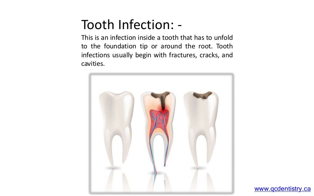 6 Most Common Dental Diseases You Should Know