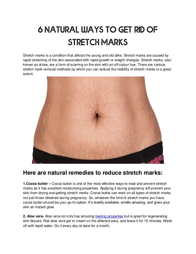 7 Essential Oils to Get Rid of Stretch Marks Fast