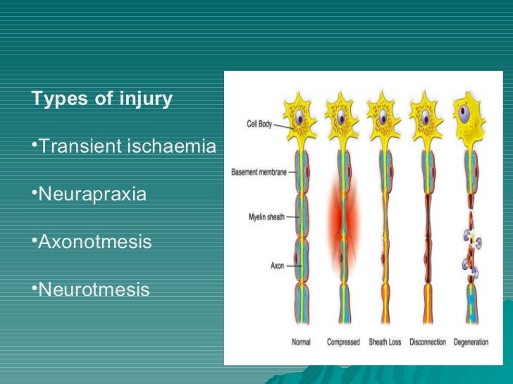 orthopedics,peripheral nerve injury.(dr.baxtiar rasul)