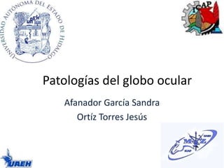 Patologías del globo ocular 
Afanador García Sandra 
Ortíz Torres Jesús 
 