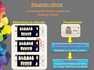 ¿Cual juego de dientes escojo con
respecto al alto?
Alternativas de selección Procedimiento
Altura de diente artificial mayor
a la longitud establecida en el rodete
RECORTAR EL TALÓN DEL DIENTE
Altura excesiva
DESGASTAR SUPERFICIE EXTERNA
DE LA BASE PROTÉSICA (CALIBRAR)
10.8
 