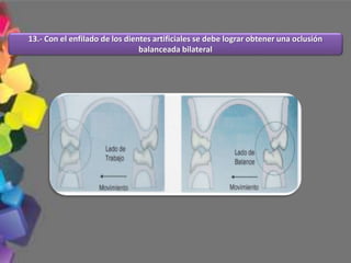 13.- Con el enfilado de los dientes artificiales se debe lograr obtener una oclusión
balanceada bilateral
 