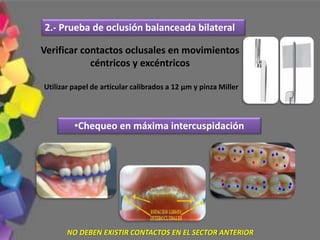 Verificar contactos oclusales en movimientos
céntricos y excéntricos
Utilizar papel de articular calibrados a 12 µm y pinza Miller
2.- Prueba de oclusión balanceada bilateral
•Chequeo en máxima intercuspidación
NO DEBEN EXISTIR CONTACTOS EN EL SECTOR ANTERIOR
 