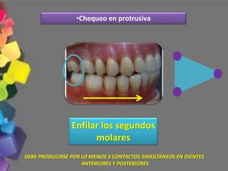 •Chequeo en protrusiva
DEBE PRODUCIRSE POR LO MENOS 3 CONTACTOS SIMULTÁNEOS EN DIENTES
ANTERIORES Y POSTERIORES
Enfilar los segundos
molares
 