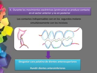 Los contactos indispensables son en los segundos molares
simultáneamente con los incisivos
4.- Durante los movimientos excéntricos (protrusiva) se produce contacto
en el sector anterior y no en posterior
Desgastar cara palatina de dientes anterosuperiores
Hundir dientes anteroinferiores
 