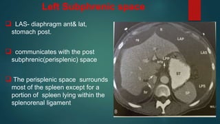 Left Subphrenic space
 LAS- diaphragm ant& lat,
stomach post.
 communicates with the post
subphrenic(perisplenic) space
 The perisplenic space surrounds
most of the spleen except for a
portion of spleen lying within the
splenorenal ligament
 