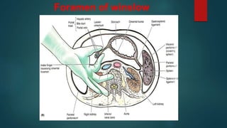 Foramen of winslow
 