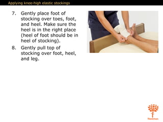 Applying knee-high elastic stockings
7. Gently place foot of
stocking over toes, foot,
and heel. Make sure the
heel is in the right place
(heel of foot should be in
heel of stocking).
8. Gently pull top of
stocking over foot, heel,
and leg.
 