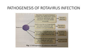 PATHOGENESIS OF ROTAVIRUS INFECTION
 