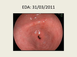 EDA: 31/03/2011
 