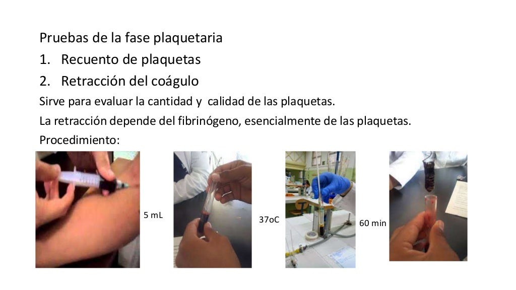6 Pruebas de coagulacion 6 Pruebas de coagulacion