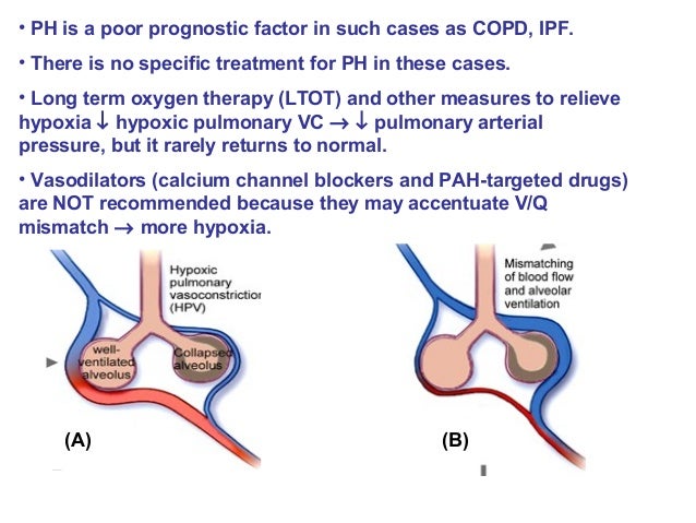 6 pulmonary hypertension