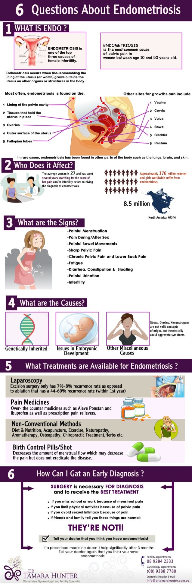 6 Questions About Endometriosis