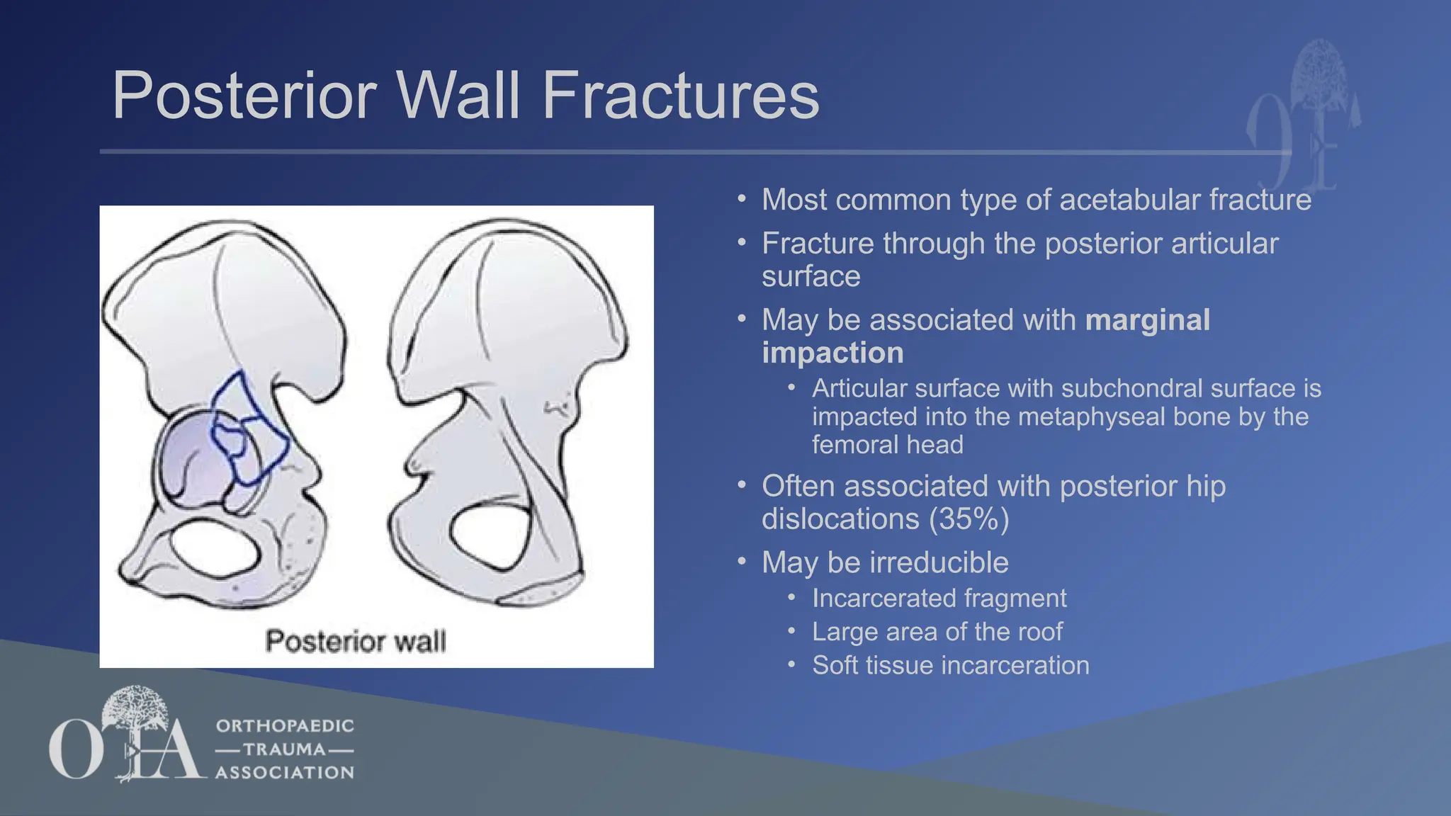6_Radiographic Understanding, Evaluation & Classification of Acetabular ...