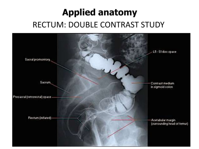 Anatomy of Rectum | PPTX