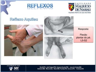 Resposta:

   Flexão
plantar do pé.
    L5-S2
 