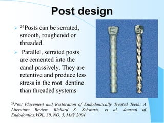 restorationoftheendodonticallytreatedtooth | PDF