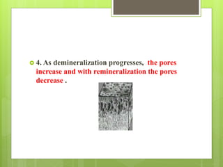  4. As demineralization progresses, the pores
increase and with remineralization the pores
decrease .
 