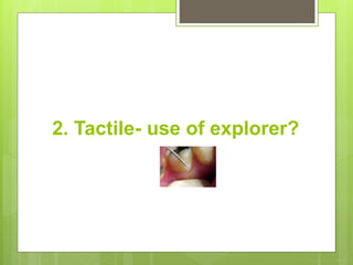 2. Tactile- use of explorer?
 