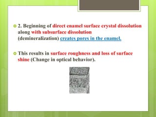  2. Beginning of direct enamel surface crystal dissolution
along with subsurface dissolution
(demineralization) creates pores in the enamel.
 This results in surface roughness and loss of surface
shine (Change in optical behavior).
 