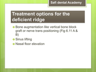 [6]role of avialable bone on dental implants [ 6 ] (3).pptx