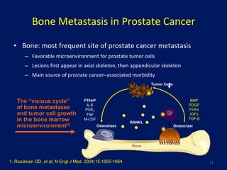 Bone Metastasis in Prostate Cancer Bone: most frequent site of prostate cancer metastasis Favorable microenvironment for prostate tumor cells Lesions first appear in axial skeleton, then appendicular skeleton Main source of prostate cancer –associated morbidity 1. Roodman GD, et al. N Engl J Med. 2004;15:1655-1664. The “vicious cycle”  of bone metastases and tumor cell growth in the bone marrow microenvironment [1] RANKL Tumor Cells PTHrP IL-6 PGE 2 TNF M-CSF Osteoclast Bone BMP PDGF FGFs IGFs TGF- β Osteoblast 