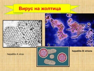 hepatitis A virus
hepatitis B virions
Вирус на жолтица
 