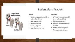 6 Slipped Capital Femoral Epiphysis PDF (2).pdf