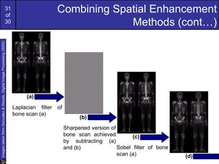 31
                                                             of
                                                                                         Combining Spatial Enhancement
                                                             30                                       Methods (cont…)
Images taken from Gonzalez & Woods, Digital Image Processing (2002)




                                                                           (a)
                                                                      Laplacian filter   of
                                                                      bone scan (a)
                                                                                                    (b)
                                                                                              Sharpened version of
                                                                                              bone scan achieved         (c)
                                                                                              by subtracting (a)
                                                                                              and (b)              Sobel filter of bone
                                                                                                                   scan (a)               (d)
 