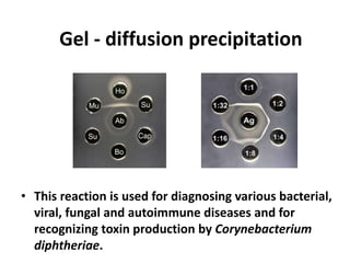 Gel - diffusion precipitation 
• This reaction is used for diagnosing various bacterial, 
viral, fungal and autoimmune diseases and for 
recognizing toxin production by Corynebacterium 
diphtheriae. 
 