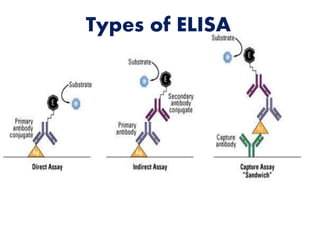 Types of ELISA 
 
