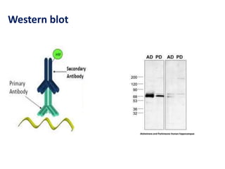 Western blot 
 