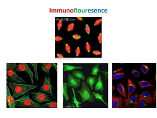 Immunoflouresence 
 