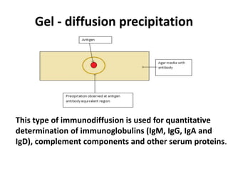 Gel - diffusion precipitation 
This type of immunodiffusion is used for quantitative 
determination of immunoglobulins (IgM, IgG, IgA and 
IgD), complement components and other serum proteins. 
 