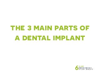 the 3 main parts of
a dental implant
 