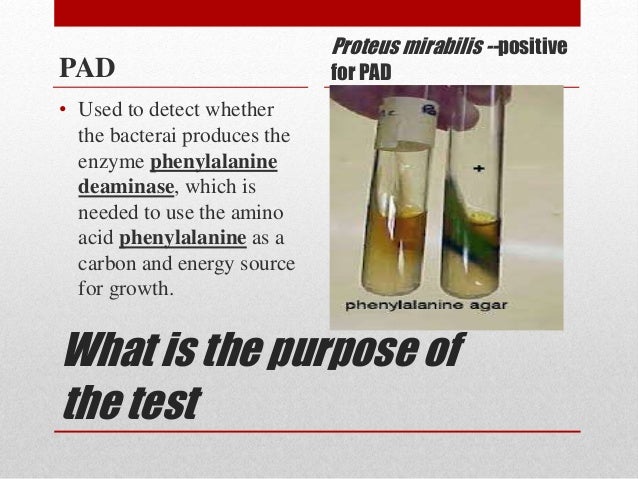 Pad Test In Microbiology – Food Microbiology Testing – KJDNPR