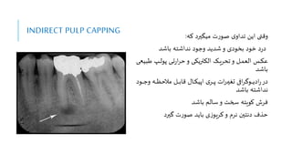 INDIRECT PULP CAPPING ‫که‬ ‫میگیرد‬ ‫ت‬‫ر‬‫صو‬ ‫ی‬‫تداو‬ ‫ایع‬ ‫وقتی‬
:
‫باشد‬ ‫نداشته‬ ‫وجود‬ ‫شدید‬‫و‬ ‫بخودی‬ ‫ود‬ ‫د‬‫ر‬‫د‬
‫ط‬ ‫وپ‬‫و‬‫و‬‫ل‬‫پو‬ ‫وی‬‫و‬‫و‬‫ت‬‫ر‬‫ا‬‫ر‬‫ح‬‫و‬ ‫وی‬‫و‬‫و‬‫ک‬‫النتری‬ ‫وو‬‫و‬‫و‬‫ی‬‫ر‬ ‫ت‬‫و‬ ‫ول‬‫و‬‫و‬‫م‬‫الع‬ ‫وس‬‫و‬‫و‬‫ن‬‫ع‬
‫و‬‫و‬‫و‬‫ع‬‫بی‬
‫باشد‬
‫و‬ ‫وه‬‫و‬‫و‬‫و‬‫و‬‫ظ‬‫مالح‬ ‫ول‬‫و‬‫و‬‫و‬‫و‬‫ب‬‫قا‬ ‫وا‬‫و‬‫و‬‫و‬‫و‬‫ک‬‫اپی‬ ‫ی‬‫ور‬‫و‬‫و‬‫و‬‫و‬‫پ‬ ‫ات‬‫ر‬‫و‬‫و‬‫و‬‫و‬‫و‬‫ی‬‫تا‬ ‫ا‬‫ر‬‫ووی‬‫و‬‫و‬‫و‬‫و‬‫ی‬‫اد‬‫ر‬‫در‬
‫وود‬‫و‬‫و‬‫و‬‫و‬‫ج‬
‫باشد‬ ‫نداشته‬
‫باشد‬ ‫سالم‬‫و‬ ‫سخت‬ ‫کویته‬ ‫فرش‬
‫ییرد‬ ‫ت‬‫ر‬‫صو‬ ‫باید‬ ‫ی‬‫ز‬‫کریو‬‫و‬ ‫نرم‬ ‫دنتین‬ ‫حذف‬
 