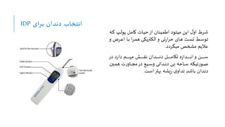 ‫برای‬ ‫دندان‬ ‫انتخاب‬
IDP
‫و‬‫ک‬ ‫وپ‬‫ل‬‫پو‬ ‫ول‬‫م‬‫کا‬ ‫وات‬‫ی‬‫ح‬‫از‬ ‫اطمینان‬ ‫میتود‬ ‫ایع‬ ‫او‬ ‫شرط‬
‫ه‬
‫ور‬‫و‬‫ع‬‫ا‬ ‫وا‬‫و‬‫ب‬ ‫ا‬‫ر‬‫و‬‫و‬‫م‬‫ه‬ ‫وی‬‫و‬‫ک‬‫النتری‬‫و‬ ‫وی‬‫و‬‫ت‬‫ر‬‫ا‬‫ر‬‫ح‬ ‫وای‬‫و‬‫ه‬ ‫وت‬‫و‬‫س‬‫ت‬ ‫و‬‫و‬‫س‬‫تو‬
‫و‬ ‫ض‬
‫میگردد‬ ‫مشخص‬ ‫عالیم‬
.
‫در‬ ‫د‬‫ر‬‫دا‬ ‫وم‬‫و‬‫و‬‫و‬‫و‬‫و‬‫و‬‫و‬‫و‬‫و‬‫و‬‫و‬‫و‬‫ه‬‫م‬ ‫وش‬‫و‬‫و‬‫و‬‫و‬‫و‬‫و‬‫و‬‫و‬‫و‬‫و‬‫و‬‫و‬‫ق‬‫ن‬ ‫ودان‬‫و‬‫و‬‫و‬‫و‬‫و‬‫و‬‫و‬‫و‬‫و‬‫و‬‫و‬‫و‬‫ن‬‫د‬ ‫ول‬‫و‬‫و‬‫و‬‫و‬‫و‬‫و‬‫و‬‫و‬‫و‬‫و‬‫و‬‫و‬‫م‬‫تکا‬ ‫ه‬‫ز‬‫ودا‬‫و‬‫و‬‫و‬‫و‬‫و‬‫و‬‫و‬‫و‬‫و‬‫و‬‫و‬‫و‬‫ن‬‫ا‬‫و‬ ‫وع‬‫و‬‫و‬‫و‬‫و‬‫و‬‫و‬‫و‬‫و‬‫و‬‫و‬‫و‬‫و‬‫س‬
‫وی‬‫و‬‫و‬‫م‬‫ه‬ ‫ت‬‫ر‬‫واو‬‫و‬‫و‬‫ج‬‫م‬‫در‬ ‫ویا‬‫و‬‫و‬‫س‬‫و‬ ‫ودانی‬‫و‬‫و‬‫ن‬‫د‬ ‫وی‬‫و‬‫و‬‫ب‬ ‫واحه‬‫و‬‫و‬‫س‬ ‫تینه‬‫ر‬‫وو‬‫و‬‫و‬‫ص‬
‫ن‬
‫است‬‫بلتر‬ ‫یشه‬‫ر‬ ‫ی‬‫تداو‬ ‫باشد‬ ‫دندان‬
.
 
