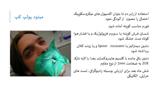 ‫کپ‬ ‫پولپ‬ ‫میتود‬
‫وک‬‫و‬‫س‬‫و‬‫مینر‬ ‫وای‬‫و‬‫ه‬‫ر‬‫ژ‬‫وپو‬‫و‬‫س‬‫اک‬ ‫ووان‬‫و‬‫ت‬‫ب‬ ‫وا‬‫و‬‫ت‬ ‫دم‬‫ور‬‫و‬‫ب‬‫ا‬‫ر‬‫از‬ ‫وتفاده‬‫و‬‫س‬‫ا‬
‫وپیو‬
‫نمود‬ ‫آلودگی‬‫از‬ ‫ن‬‫مصو‬ ‫ا‬‫ر‬ ‫احتمال‬
‫شود‬ ‫آماده‬ ‫کویته‬ ‫مناسب‬ ‫م‬‫ر‬‫فو‬
‫و‬‫و‬‫و‬‫ش‬‫ف‬ ‫وا‬‫و‬‫و‬‫ب‬‫و‬ ‫وو‬‫و‬‫و‬‫ی‬‫ژ‬‫فزیولو‬ ‫ویروم‬‫و‬‫و‬‫س‬ ‫وا‬‫و‬‫و‬‫ب‬ ‫وه‬‫و‬‫و‬‫ت‬‫کوی‬ ‫ورش‬‫و‬‫و‬‫ف‬ ‫وتن‬‫و‬‫و‬‫س‬‫ش‬
‫ووا‬‫و‬‫و‬‫ه‬‫ار‬
‫شود‬ ‫شو‬ ‫مدت‬ ‫کوتاه‬
‫وا‬‫و‬‫و‬‫و‬‫ب‬‫ور‬‫و‬‫و‬‫و‬‫ی‬‫ال‬‫ر‬‫دیمی‬ ‫وین‬‫و‬‫و‬‫و‬‫ت‬‫دن‬
Spoon excavator
‫والن‬‫و‬‫و‬‫و‬‫ک‬ ‫ود‬‫و‬‫و‬‫و‬‫ن‬‫و‬‫ر‬ ‫وا‬‫و‬‫و‬‫و‬‫ی‬‫و‬
‫شود‬ ‫برداشته‬
‫با‬ ‫بعدا‬ ‫کساید‬‫و‬‫هایدر‬ ‫کاسیم‬ ‫با‬ ‫مانده‬ ‫باق‬ ‫دنتین‬
‫واز‬‫ن‬ ‫الیه‬
ZOE
‫ضخامت‬ ‫به‬
2mm
‫مقاوم‬ ‫نوع‬‫از‬
‫و‬‫س‬‫ت‬ ‫ا‬‫ر‬‫ووی‬‫ی‬‫اد‬‫ر‬ ‫ویاه‬‫س‬‫بو‬ ‫وابی‬‫ی‬‫ز‬‫ار‬ ‫ای‬‫ر‬‫و‬‫ب‬ ‫ود‬‫ع‬‫ب‬ ‫واه‬‫م‬ ‫شش‬
‫وای‬‫ه‬ ‫ت‬
‫النتریکی‬ ‫تی‬‫ر‬‫ا‬‫ر‬‫ح‬
 