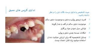 ‫عمیق‬ ‫های‬ ‫کریس‬ ‫ی‬‫تداو‬
‫نظر‬‫در‬ ‫ا‬‫ر‬ ‫ذیل‬ ‫نکات‬ ‫ست‬‫ر‬‫د‬ ‫ی‬‫تداو‬‫و‬ ‫تشخیص‬ ‫جهت‬
‫باشید‬ ‫داشته‬
:
.1
‫ت‬‫ر‬‫قد‬
‫دنتین‬ ‫موجودیت‬‫و‬ ‫دنتین‬‫و‬ ‫پولپ‬ ‫ترمیمی‬
‫س‬
‫الم‬
.2
‫کویته‬‫جدار‬‫و‬ ‫کف‬‫در‬ ‫سالم‬ ‫دنتین‬ ‫موجودیت‬
.3
‫توانایی‬
‫ی‬‫پرکار‬ ‫مواد‬ ‫نمودن‬ ‫سیل‬
.4
‫و‬ ‫دنتین‬ ‫بعدی‬ ‫صدمه‬ ‫امکانات‬
‫پولپ‬
.5
‫وسایل‬
‫دن‬ ‫حیاتیت‬ ‫یابی‬‫ز‬‫ار‬ ‫ای‬‫ر‬‫ب‬ ‫که‬ ‫تشخیصیه‬
‫دان‬
‫نیست‬ ‫اعتماد‬ ‫قابل‬ ‫یاد‬‫ز‬ ‫میشود‬ ‫استفاده‬
 
